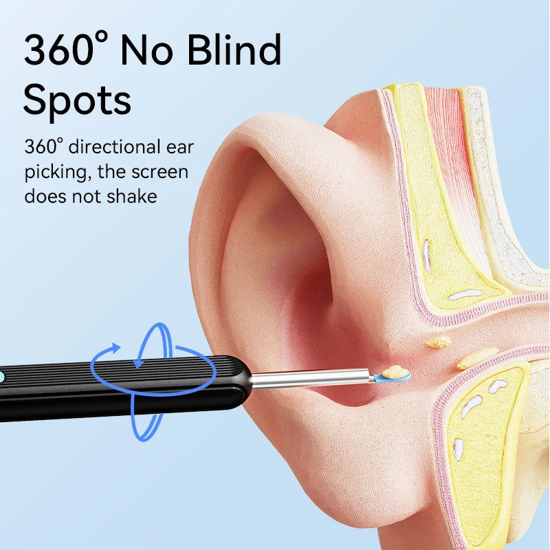 Ear Wax Removal  with Camera